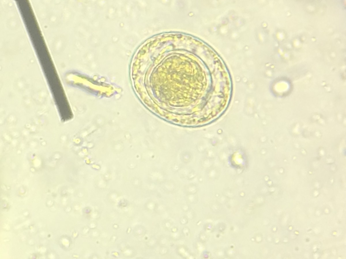 Hymenolepis nana egg