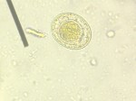 Hymenolepis nana egg